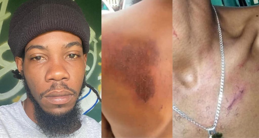 Tristan Williams Pleads Not Guilty to Charges Following Alleged Police Brutality