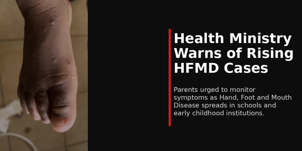 Health Ministry Raises Concern Over Increase in Hand, Foot and Mouth Disease Cases